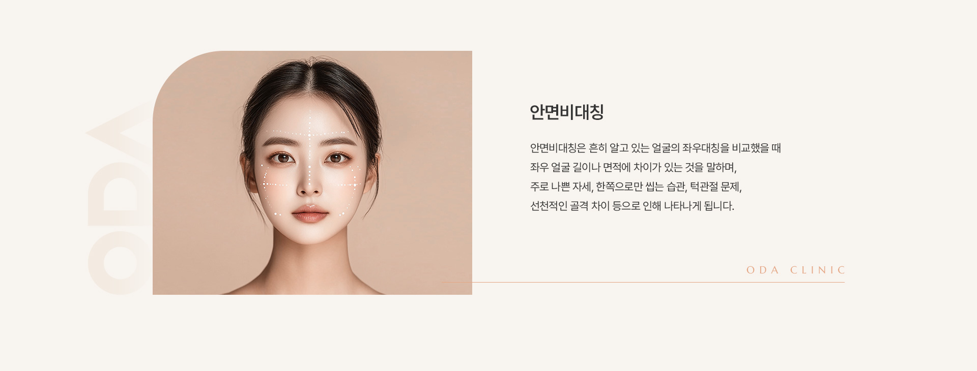 안면비대칭 상세02