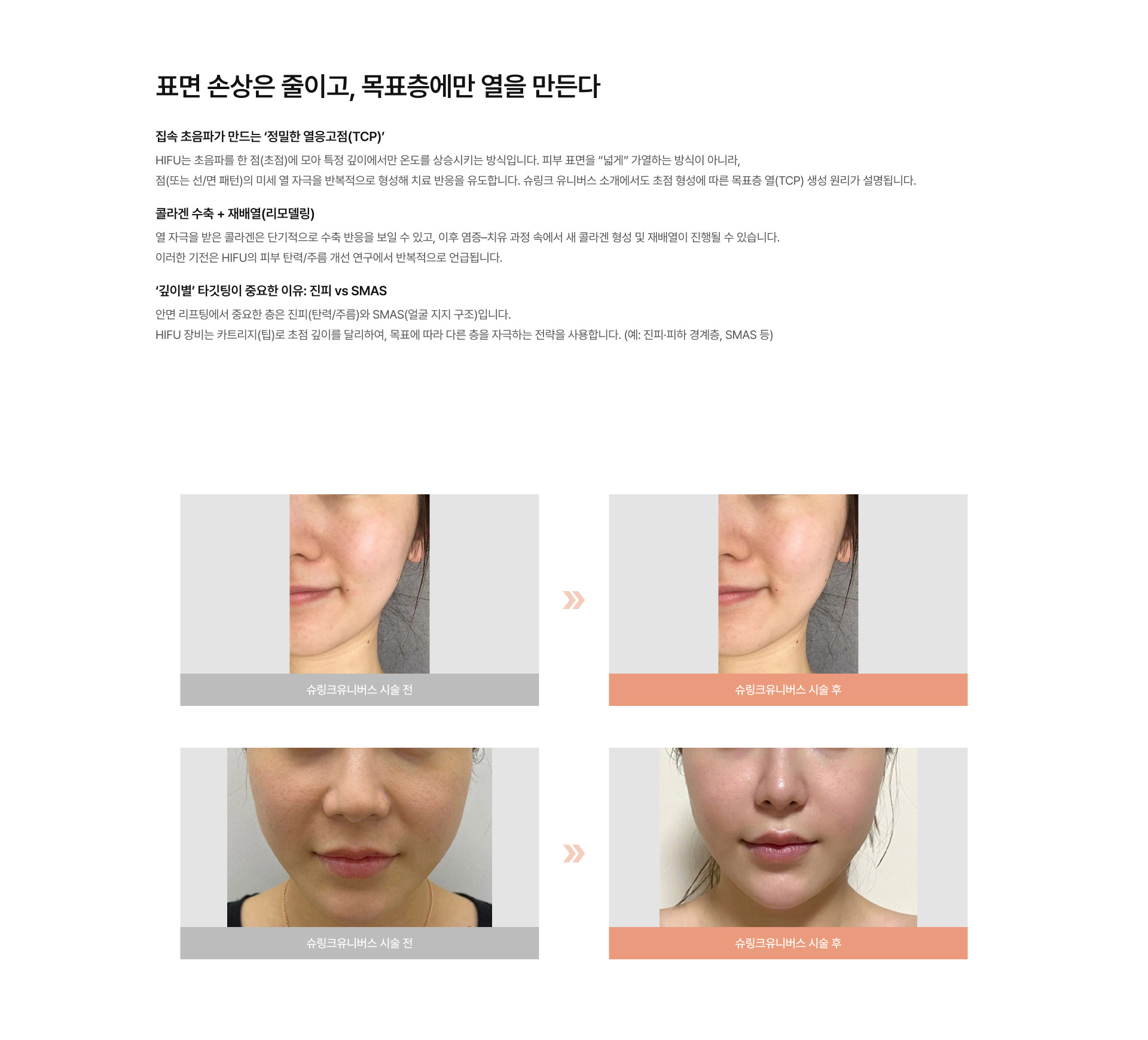 슈링크 유니버스 02