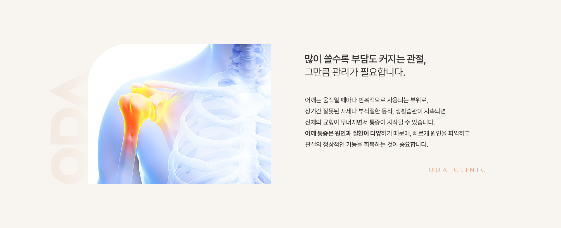 어깨통증 상세02